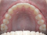 horn pac4