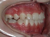 pravo pac3